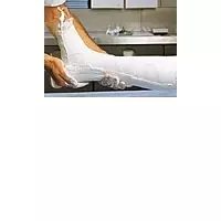 CELLONA Gipsbinden 15 cmx2 m 10 St Binden