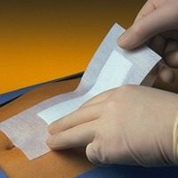 PRIMAPORE Wundverb.5x7,5 cm steril 100 St Verband