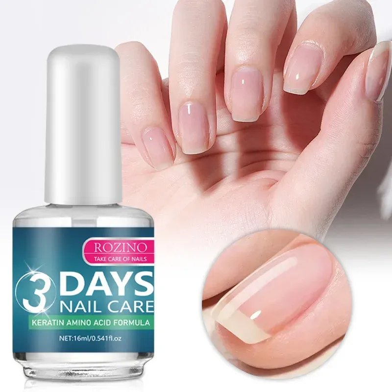 1/2/3 Stück Nagelpflege-Gel-Reparaturpflanze, glatte, nährende Nägel, natürliche Pflege, stärkt das Revitalizer-Öl für die Nagelreparatur und Reinigung