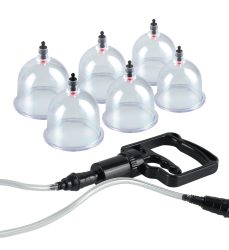 Schröpf-Set ?Beginner?s 6 pc. Cupping Set?
