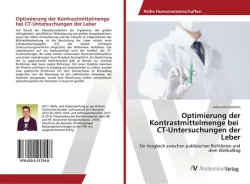 Optimierung der Kontrastmittelmenge bei CT-Untersuchungen der Leber