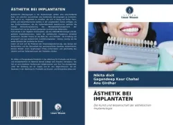 Ästhetik bei Implantaten