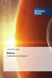 Retina