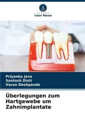 Überlegungen zum Hartgewebe um Zahnimplantate